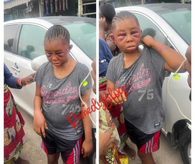 Photos: See What A Guy Did To A Lady He Met On Social Media Who Came To Visit Him
