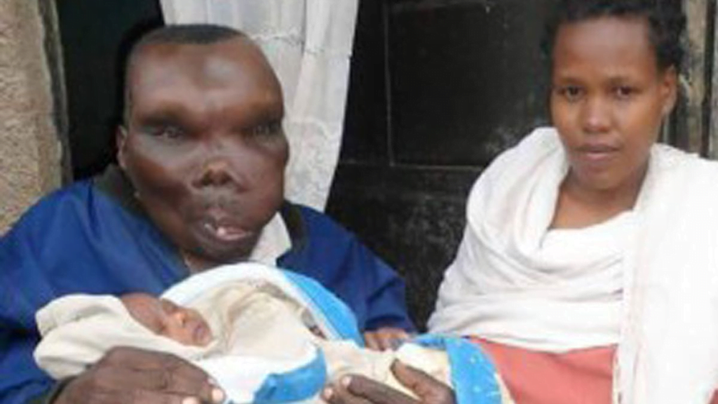 See The Condition Of The Lady Who Married The Ugliest Man In Uganda After 7 years - Photos