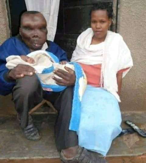 See The Condition Of The Lady Who Married The Ugliest Man In Uganda After 7 years - Photos