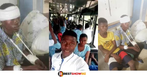 Student of Aduman SHS in critical condition after robbers butchered him and took his things