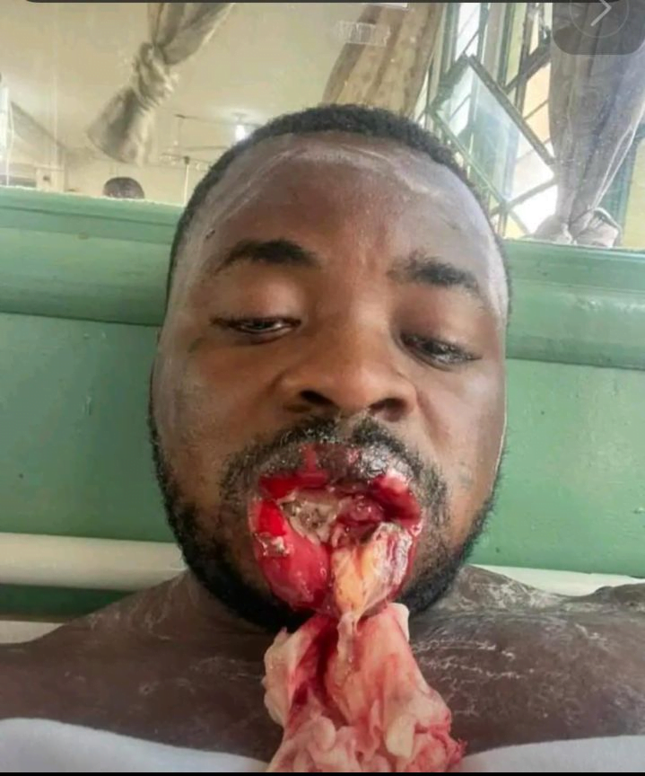 Sakawa boy gets rotten lips after the ritual he did expired