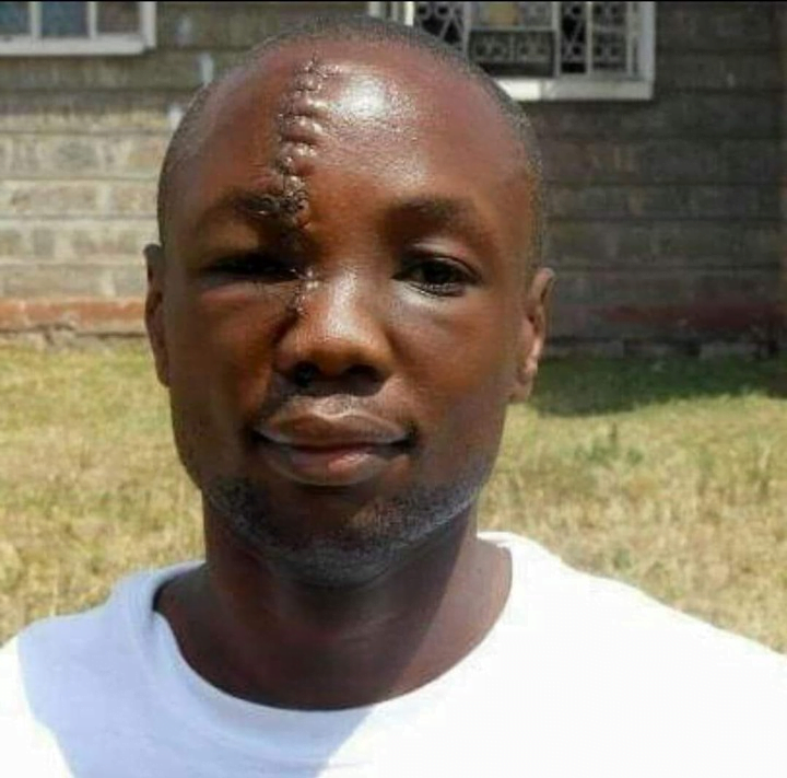"I have forgiven come back and let's stay together"- Man whose head was slashed by his girlfriend reveals he has forgiven her.