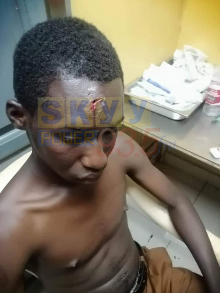 SAD: St Mary’s SHS Teacher loses his front teeth in Inter-co clash with GSTS (Photos)