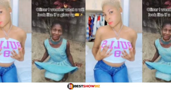 Lady shares her amazing transformation from black to white (Video)
