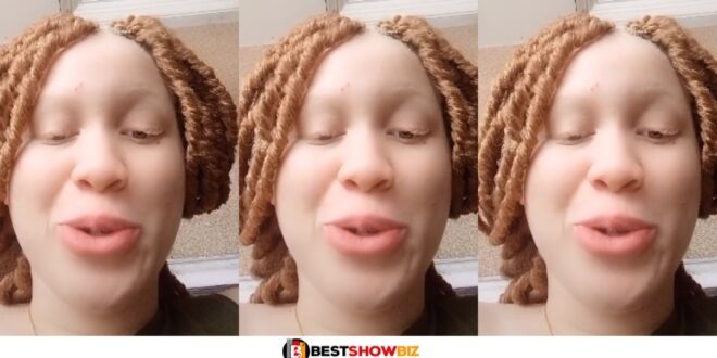 "My parents never allowed me to go out that is why my skin is perfect"- Nigerian Albino Lady reveals (watch video)