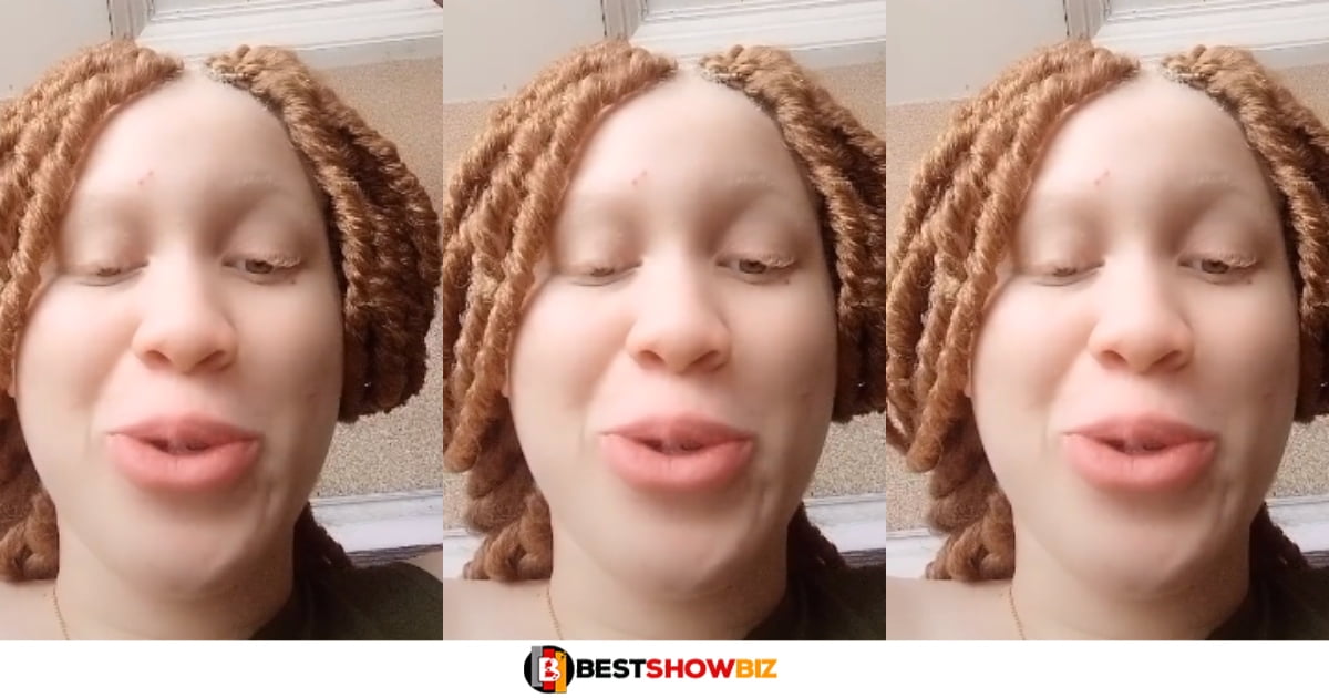 "My parents never allowed me to go out that is why my skin is perfect"- Nigerian Albino Lady reveals (watch video)