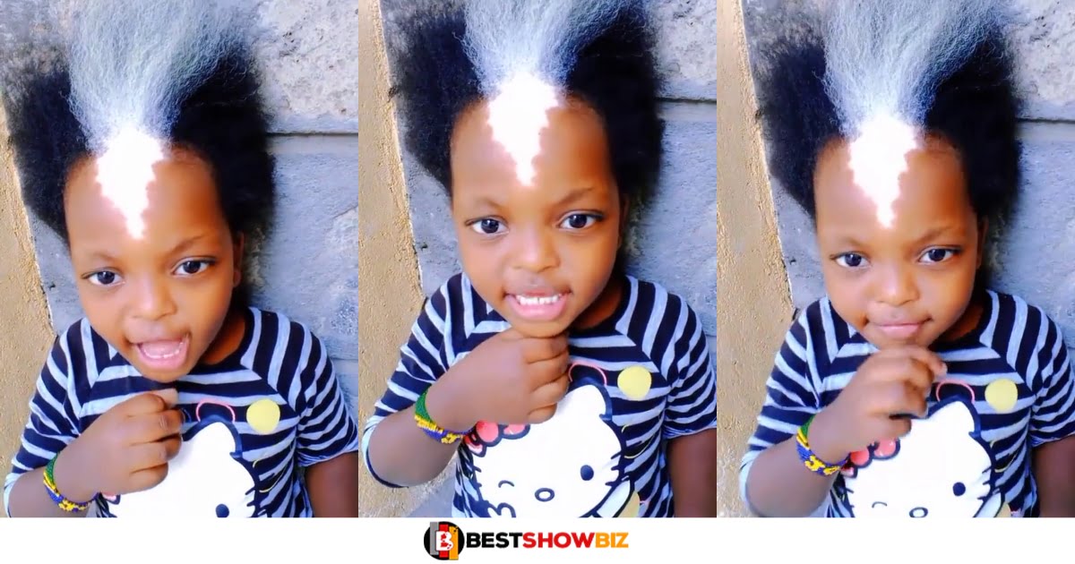 Beautiful young girl with an unusual birthmark goes viral online (Watch video)