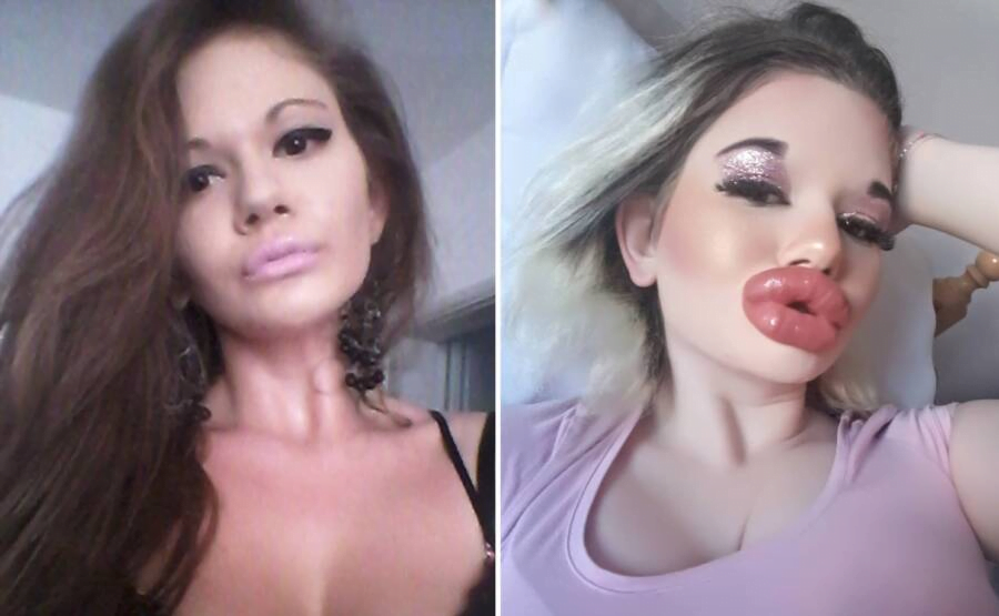 Woman with the biggest lips in the world, Andrea Ivanova