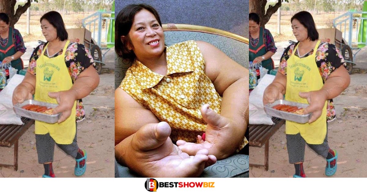 See More Photos Of The Woman With The Largest Hands In The World