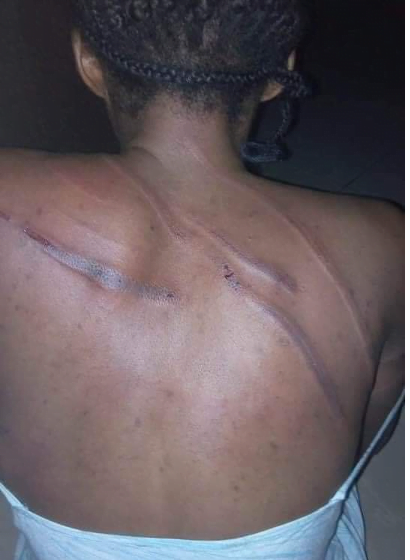 "I married my enemy"-Lady reveals as she Runs Away From Her Abusive Husband Who Almost Took Her Life