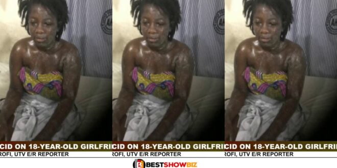 54-year-old businessman pours ac!d on his 18-year-old girlfriend (watch video)