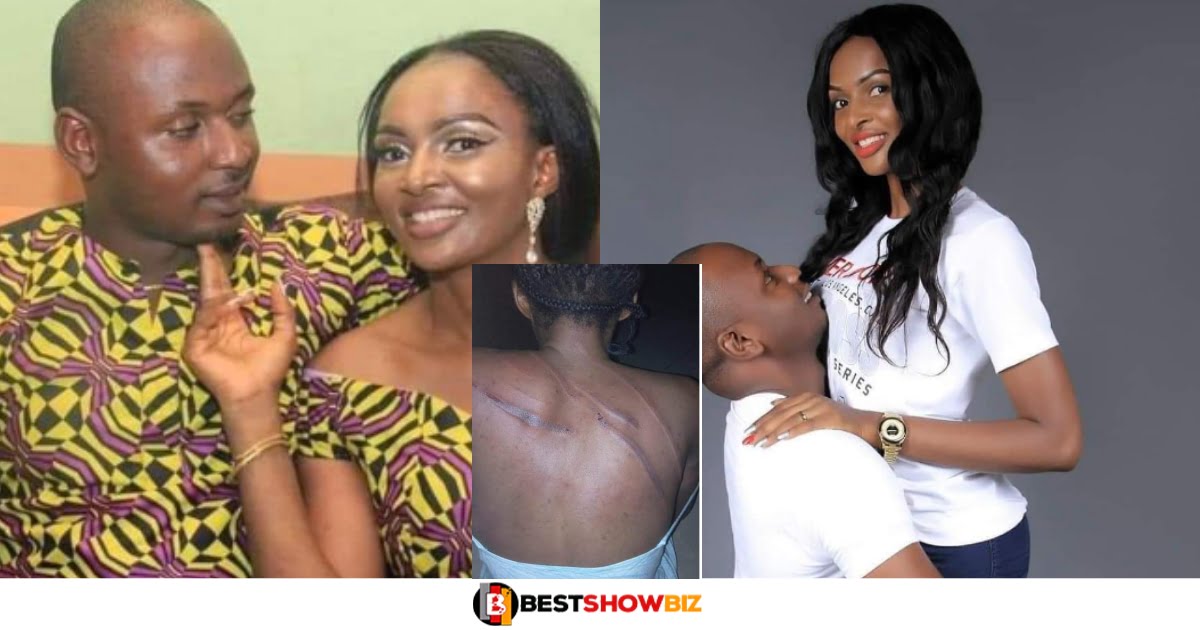 "I married my enemy"-Lady reveals as she Runs Away From Her Abusive Husband Who Almost Took Her Life