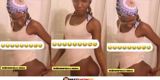 Nyᾶsh Surgery Goes Wrong: Lady Surfaces With Strange Nyᾶsh In New Video