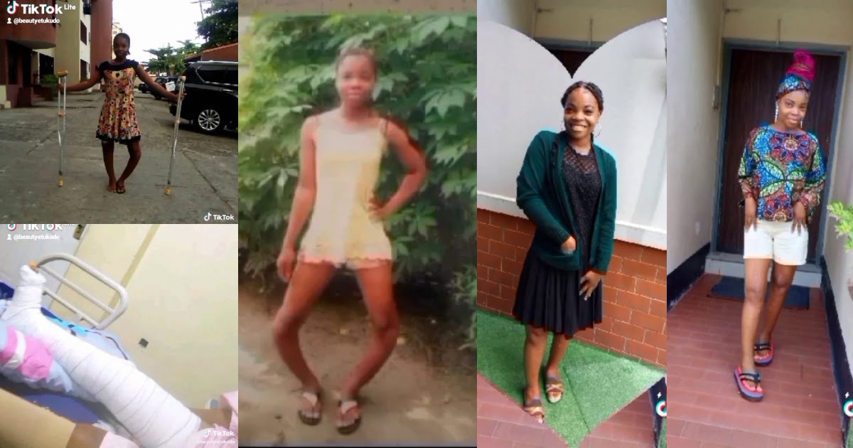 Lady With Bowlegs Shares Beautiful Transformation After Corrective Surgery - Video