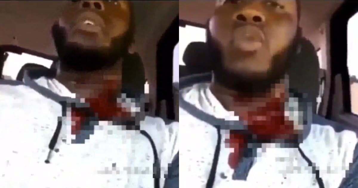 A Man Sh0t in the Neck Sends a Stern Warning to His Shooter on Social Media