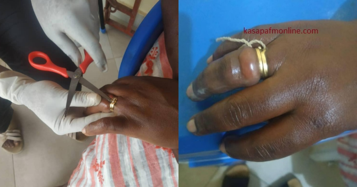 Woman nearly lose her finger after buying wedding ring from friend
