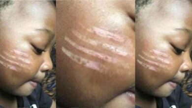 Teacher gives tribal marks on the face of someone's child with a hot fork in school