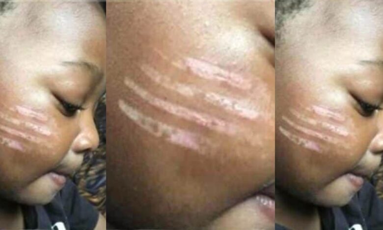 Teacher gives tribal marks on the face of someone's child with a hot fork in school