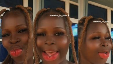 Young Lady shows off her big reddish lips after undergoing surgery – Watch Video