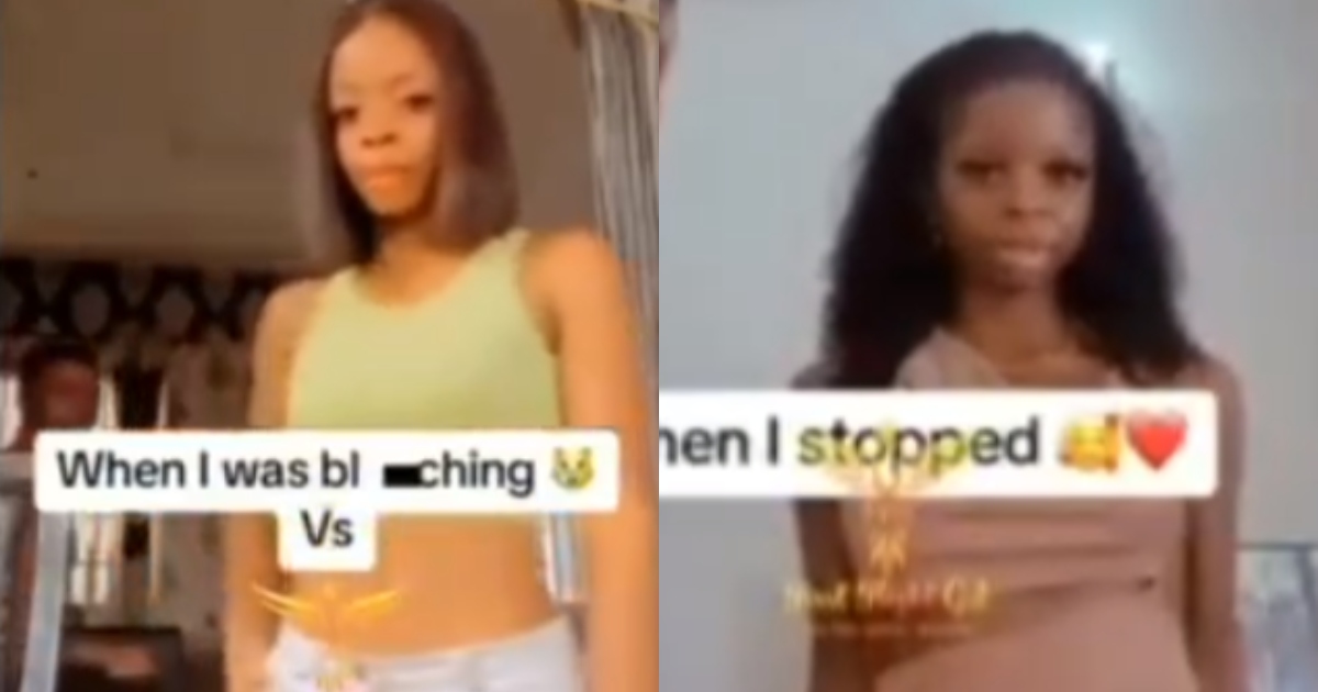 An amazing transformation video is shared by a lady titled "When bleaching vs stopped by me."
