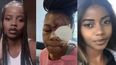 Man beats and destroys the eye of a beautiful lady for refusing to accept his proposal