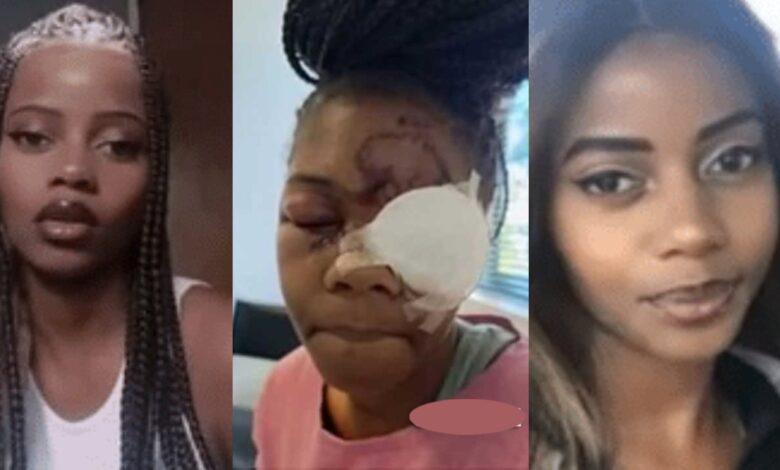 Man beats and destroys the eye of a beautiful lady for refusing to accept his proposal