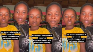 Mother cries for help as her 7-year-old son has never blinked his eyes and closed his mouth since birth - Video