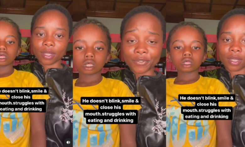Mother cries for help as her 7-year-old son has never blinked his eyes and closed his mouth since birth - Video