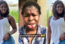 "I Did Not Do Lip Surgеry" - Barakatu Lasisi Cries Out As Her Lips Has Become 3 Times Bigger Than Normal