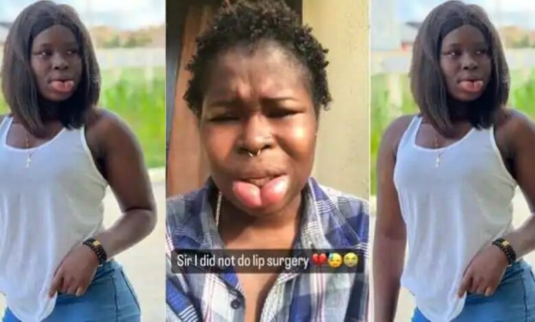 "I Did Not Do Lip Surgеry" - Barakatu Lasisi Cries Out As Her Lips Has Become 3 Times Bigger Than Normal