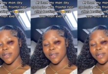 "Whenever My Boyfriend Beats Me He Apologizes With An Expensive Frontal" - A Nigerian Lady Adukе Reveals
