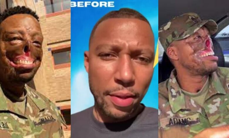 Randy Adams Goes Viral After His Heroism In The US ARMY Trends On TikTok.